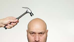 Hitting bald head with a hammer Hitting bald head with a hammer