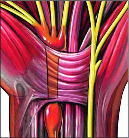 MB-0615-Hand-Gewebe-F (jpg) MB-0615-Hand-Gewebe-F (jpg)